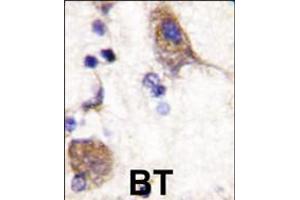 Image no. 2 for anti-SCY1-Like 2 (SCYL2) (AA 643-672), (C-Term) antibody (ABIN5537499)