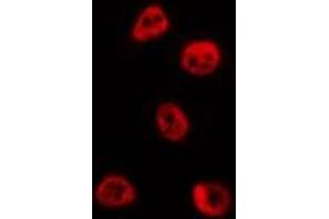 Image no. 3 for anti-B-Cell CLL/lymphoma 6 (BCL6) (Internal Region) antibody (ABIN6260236)