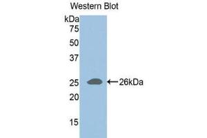 Image no. 1 for anti-ADAM Metallopeptidase with Thrombospondin Type 1 Motif, 1 (ADAMTS1) (AA 258-467) antibody (ABIN1857895)