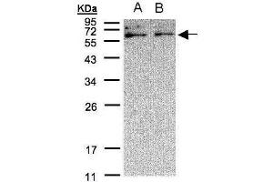 WB Image Sample(30 μg of whole cell lysate) A:A431, B:H1299 12% SDS PAGE antibody diluted at 1:500