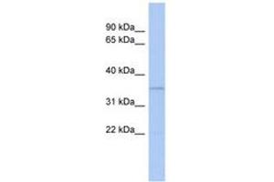 CLEC4G antibody  (AA 71-120)
