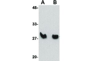 Image no. 1 for anti-Killer Cell Lectin-Like Receptor, Subfamily A, Member 2 (Klra2) (C-Term) antibody (ABIN6657459)