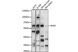 Image no. 1 for anti-Hedgehog Acyltransferase (HHAT) antibody (ABIN6293158)