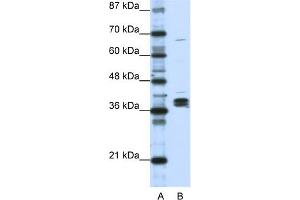 Image no. 2 for anti-Heterogeneous Nuclear Ribonucleoprotein D-Like (HNRPDL) (Middle Region) antibody (ABIN2778937)