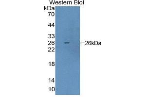 Image no. 1 for anti-Aristaless Related Homeobox (ARX) (AA 25-246) antibody (ABIN5013158)
