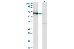Image no. 4 for anti-Golgi Membrane Protein 1 (GOLM1) (AA 302-401) antibody (ABIN565577)
