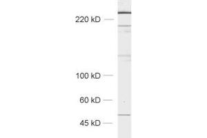 Image no. 2 for anti-Neurobeachin (NBEA) (AA 952-1320) antibody (ABIN1742400)
