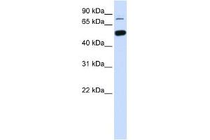 Image no. 1 for anti-SWI/SNF Related, Matrix Associated, Actin Dependent Regulator of Chromatin, Subfamily D, Member 1 (SMARCD1) (Middle Region) antibody (ABIN631626)