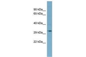 Image no. 1 for anti-Dehydrogenase/reductase (SDR Family) Member 11 (DHRS11) (AA 143-192) antibody (ABIN6741875)