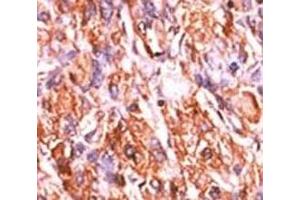 Image no. 4 for anti-Retinoblastoma Protein (Rb Protein) (pSer811) antibody (ABIN3029756)