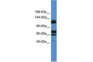 Image no. 1 for anti-Suppression of Tumorigenicity 5 (ST5) (AA 387-436) antibody (ABIN6746819)