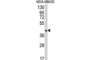 Image no. 1 for anti-1-Acylglycerol-3-Phosphate O-Acyltransferase 4 (AGPAT4) antibody (ABIN3003878)