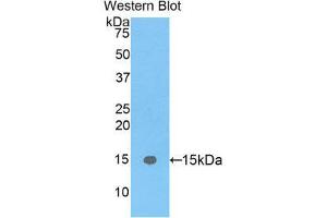Image no. 1 for anti-Fatty Acid Binding Protein 5 (Psoriasis-Associated) (FABP5) (AA 2-135) antibody (ABIN1078019)