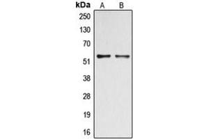 Image no. 2 for anti-DOK2 (DOK2) (pTyr299) antibody (ABIN2706052)