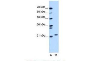 Image no. 1 for anti-RAB11B, Member RAS Oncogene Family (RAB11B) (C-Term) antibody (ABIN6738434)
