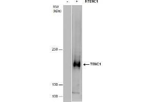 Image no. 1 for anti-Tensin Like C1 Domain Containing Phosphatase (Tensin 2) (TENC1) (C-Term) antibody (ABIN2856625)