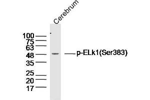 Image no. 1 for anti-ELK1, Member of ETS Oncogene Family (ELK1) (pSer383) antibody (ABIN1714907)