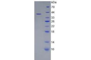 Image no. 1 for Complement Component 5a (C5a) protein (ABIN3008936)
