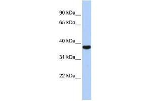 Image no. 1 for anti-Exosome Component 2 (EXOSC2) (Middle Region) antibody (ABIN633278)