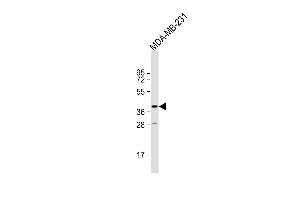 Image no. 1 for anti-Taste Receptor, Type 2, Member 44 (TAS2R31) (AA 280-309), (C-Term) antibody (ABIN5532227)