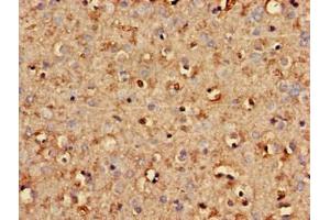 Immunohistochemistry of paraffin-embedded human brain tissue using ABIN7170725 at dilution of 1:100