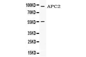 Image no. 1 for anti-APC Regulator of WNT Signaling Pathway 2 (APC2) (AA 51-90), (N-Term) antibody (ABIN4886464)