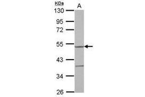 Image no. 1 for anti-Tyrosyl-tRNA Synthetase 2, Mitochondrial (YARS2) (AA 197-414) antibody (ABIN1501787)