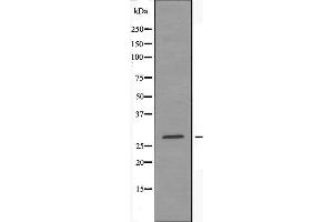 Image no. 2 for anti-14-3-3 epsilon (YWHAE) antibody (ABIN6258570)