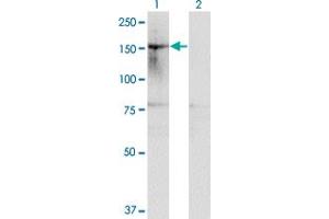 Image no. 2 for anti-Histone Deacetylase 6 (HDAC6) (AA 1128-1215) antibody (ABIN564314)