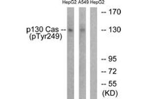 Western blot analysis of extracts from HepG2 cells treated with EGF 200ng/ml 30' and A549 cells treated with PMA 125ng/ml 30', using p130 Cas (Phospho-Tyr249) Antibody.