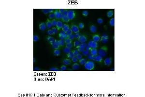 Image no. 3 for anti-Zinc Finger E-Box Binding Homeobox 1 (ZEB1) (N-Term) antibody (ABIN2777193)