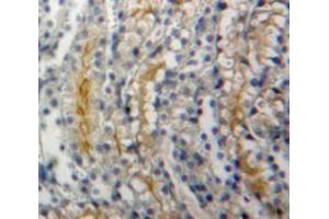 Image no. 2 for anti-Adenylate Cyclase 1 (Brain) (ADCY1) (AA 303-569) antibody (ABIN2118680)