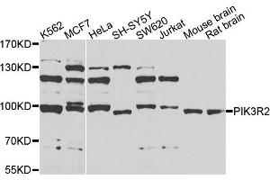 Image no. 1 for anti-Phosphoinositide 3 Kinase, p85 beta (PI3K p85b) antibody (ABIN4904756)