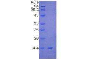 Image no. 4 for S100 Calcium Binding Protein B (S100B) ELISA Kit (ABIN6730907)