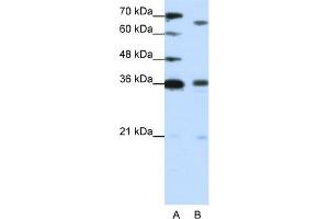 WB Suggested Anti-PRDM13 Antibody Titration:  1.