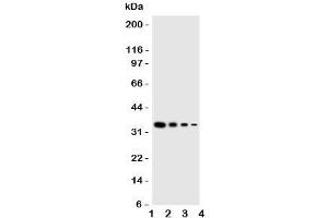Image no. 1 for anti-Eukaryotic Translation Initiation Factor 2 alpha Kinase 4 (EIF2AK4) (Middle Region) antibody (ABIN3030880)