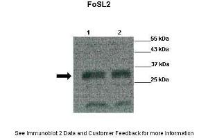 Image no. 3 for anti-FOS-Like Antigen 2 (FOSL2) (Middle Region) antibody (ABIN2777246)