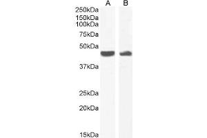 Image no. 13 for anti-Actin, alpha 2, Smooth Muscle, Aorta (ACTA2) (N-Term) antibody (ABIN185271)