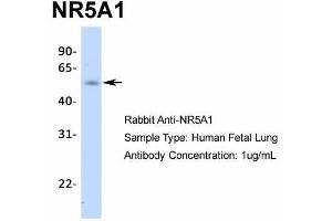 Image no. 5 for anti-Nuclear Receptor Subfamily 5, Group A, Member 1 (NR5A1) (Middle Region) antibody (ABIN2777447)