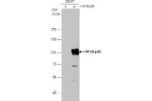 Image no. 6 for anti-Nuclear Factor-kB p65 (NFkBP65) (Center) antibody (ABIN2855287)