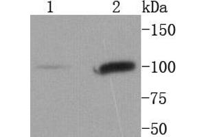 Image no. 4 for anti-Signal Transducer and Activator of Transcription 6, Interleukin-4 Induced (STAT6) antibody (ABIN5557533)