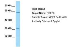 Image no. 1 for anti-Receptor Accessory Protein 3 (REEP3) (AA 154-203) antibody (ABIN6750069)