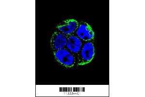 Image no. 1 for anti-Villin-Like (VILL) (Center) antibody (ABIN2493856)