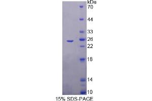 Image no. 1 for Trehalase (Brush-Border Membrane Glycoprotein) (TREH) (AA 237-420) protein (T7 tag,His tag) (ABIN6238061)