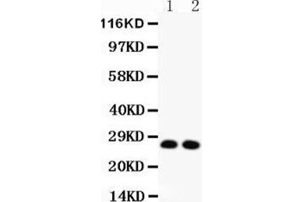 VEGFA anticorps  (AA 27-191)
