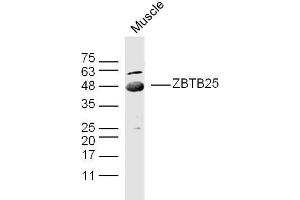 Image no. 1 for anti-Zinc Finger and BTB Domain Containing 25 (ZBTB25) (AA 341-435) antibody (ABIN2180228)
