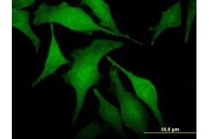SNX6 antibody  (AA 1-290)