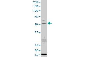 USP45 polyclonal antibody (A01), Lot # 051107JC01 Western Blot analysis of USP45 expression in SJCRH30 .