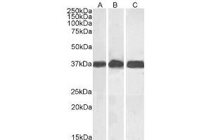 Image no. 17 for anti-Glyceraldehyde-3-Phosphate Dehydrogenase (GAPDH) (C-Term) antibody (ABIN185240)