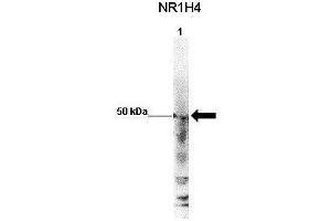 Image no. 4 for anti-Nuclear Receptor Subfamily 1, Group H, Member 4 (NR1H4) (Middle Region) antibody (ABIN2778066)